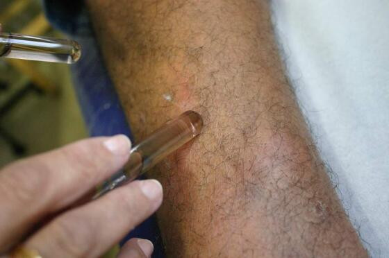 Hanseníase tem cura.jpg