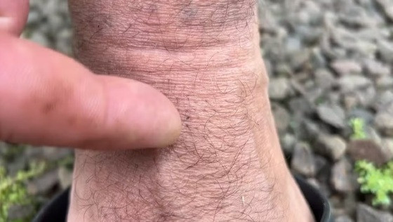Foto do mosquito-pólvora, causador da febre oropouche
