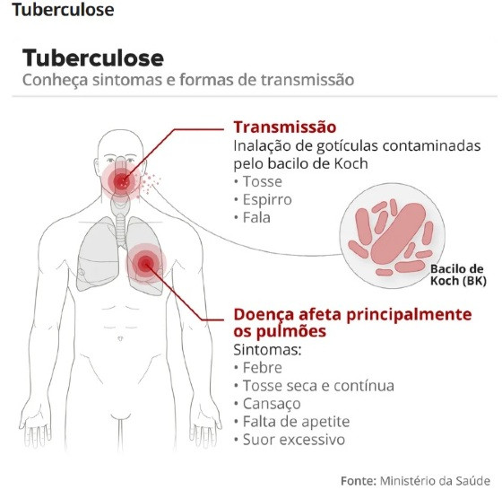 tuberculose.jpg