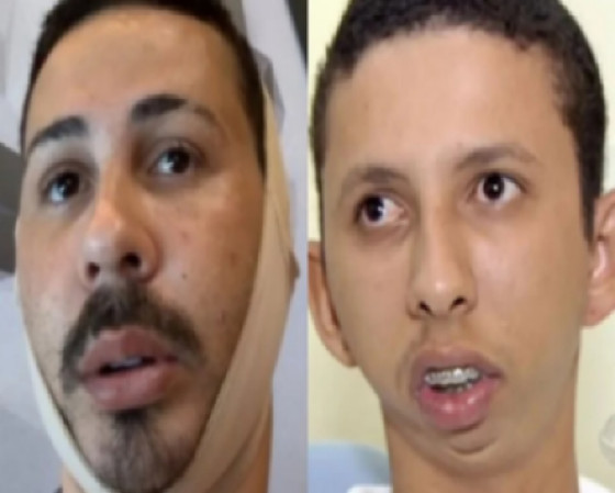 carlinhos e boca (2).png